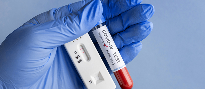 Анализы (Covid-19)
